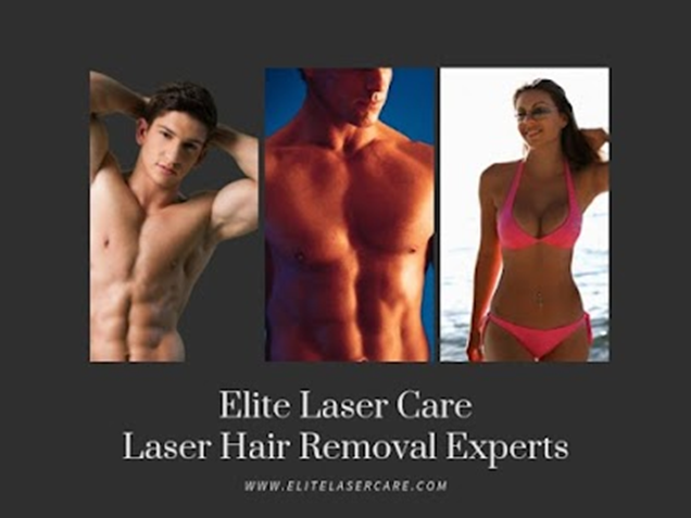 will laser hair removal work on blonde hair